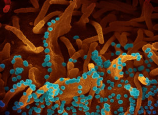 Imágenes del coronavirus, para que las personas conozcan al “enemigo invisible”