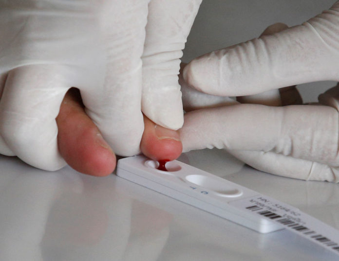 foto 2 Las pruebas de anticuerpos