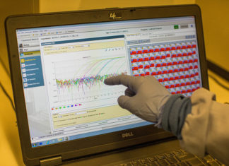 Johns Hopkins sitúa los muertos de COVID-19 a nivel mundial en los 650.000