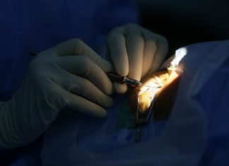 Acusan a oculista de dejar ciegos a pacientes indocumentados