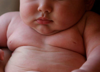 Un bebé con sobrepeso esta predispuesto a la diabetes