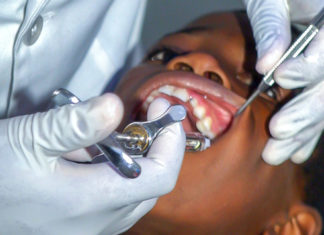 ¿Cómo afectan las encías al corazón?