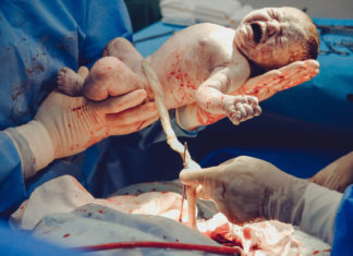 Parto humanizado, un derecho humano