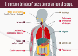 El cáncer y la comunidad hispana