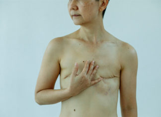 Concientizarnos de la lucha contra el cáncer y la disparidad en el acceso a la salud