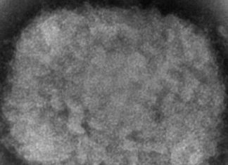 EEUU reporta primer caso de viruela símica en Massachusetts