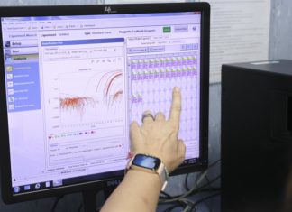 Aumentan a tres los casos de viruela del mono en República Dominicana