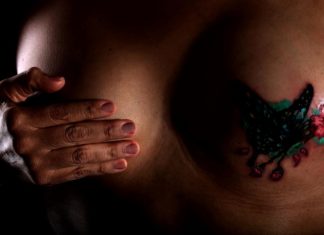 El 70 % de latinoamericanas con cáncer de mama llegan tarde al diagnóstico