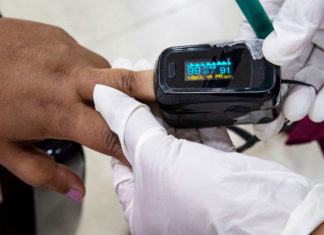 Color de piel afectaría lecturas de los oxímetros de pulso