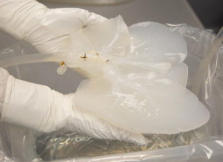 Modifican hígados de cerdo para aliviar escasez de órganos