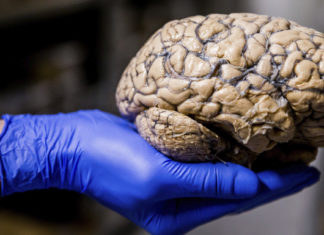 Estudio revelaría las bases neurológicas de la polarización política