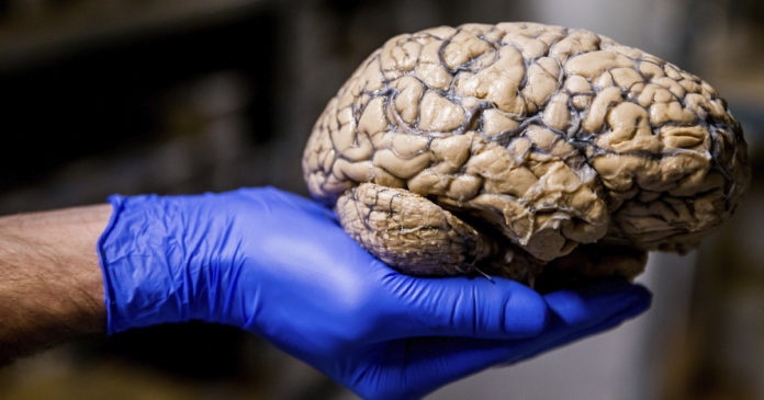 Estudio-revelaría-las-bases-neurológicas-de-la-polarización-política