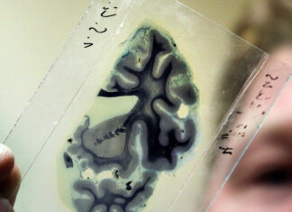 Descubren que la glicina puede ser de ayuda para aliviar la depresión severa