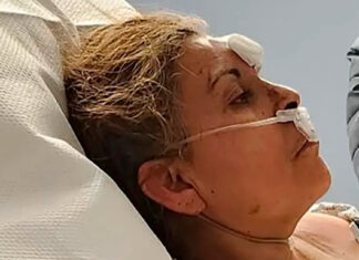 Factory explosion survivor, on fire, fell into chocolate vat