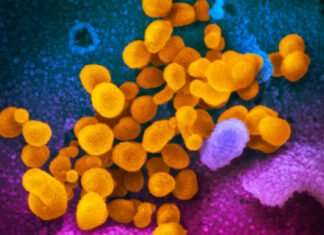 Estudio: Una de 10 personas tuvieron COVID de larga duración tras contagiarse de la variante ómicron