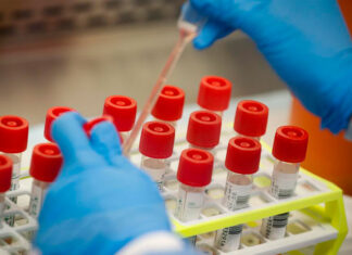 Sondeo: Cae la confianza en la ciencia y la medicina en EE. UU.