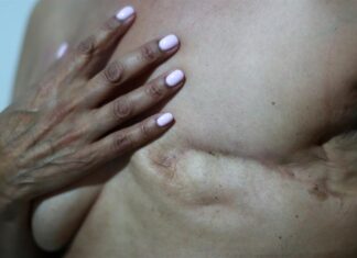 Un «caballo de Troya» farmacológico da una oportunidad al cáncer con alto nivel de HER2