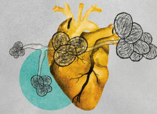 Dangerous fungus is becoming more prevalent. Scientists believe climate change could be to blame