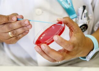 Los casos de sífilis en EE. UU. aumentan a los niveles más altos en los últimos 70 años sífilis