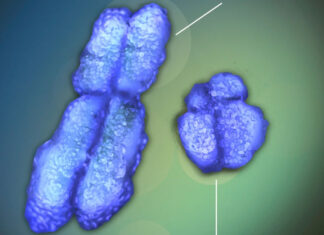 Enfermedades autoinmunes atacan más a mujeres que hombres: claves sobre el motivo autoinmunes