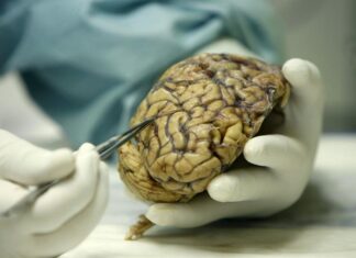 Identifican un área del cerebro que responde a las amenazas, según un estudio cerebro