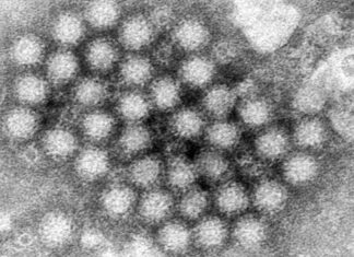 Norovirus illnesses are up in some places. Here’s what you need to know norovirus