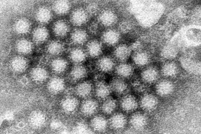norovirus