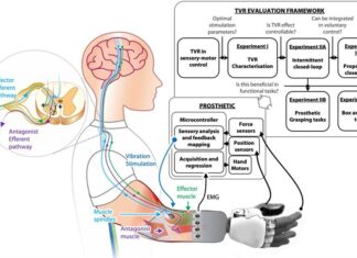 Desarrollan un dispositivo capaz de «naturalizar» la conexión entre una persona y su prótesis prótesis
