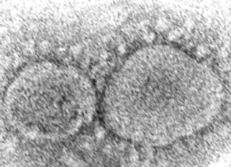 Infecciones anteriores de COVID-19 podrían ofrecer mayor protección ante resfriados, dice estudio COVID-19