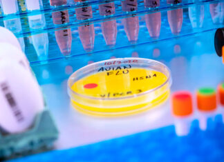 Las pruebas para la gripe aviar son difíciles de conseguir. ¿Cómo saber si estamos en una pandemia? gripe aviar