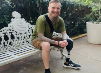 “Puedo bailar, puedo caminar”: ucranianos se rehabilitan y reciben prótesis en México prótesis