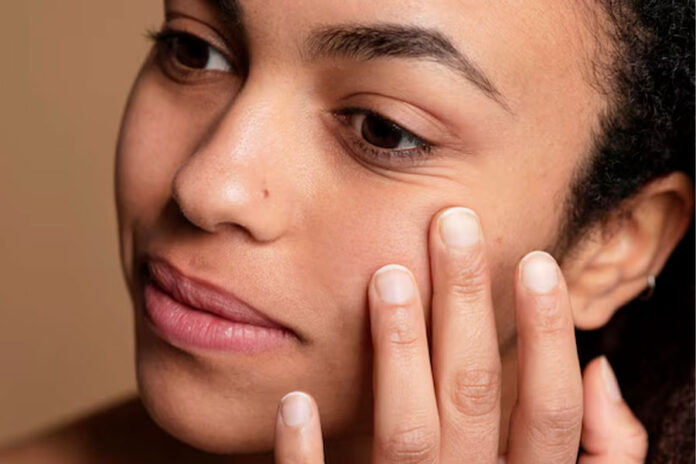 Cómo-cerrar-los-poros-y-eliminar-las-manchas-de-la-piel piel