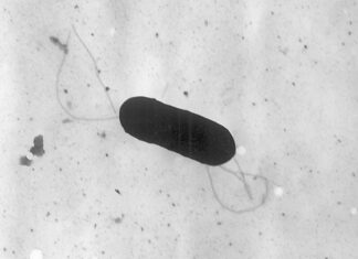 ¿Qué saber sobre los casos de listeria reportados en EE. UU.?