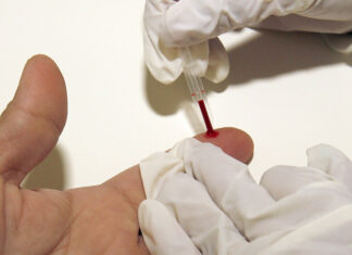 Desarrollan una inmunoterapia para revertir el daño cardíaco debido al colesterol inmunoterapia