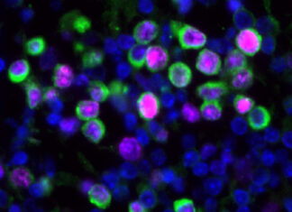 Virus respiratorios pueden despertar y promover la metástasis pulmonar del cáncer de mama
