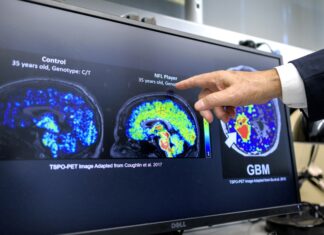 Científicos latinos en EE. UU. hallan biomarcador que podría detectar temprano el Alzheimer