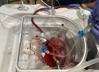 Logran primer trasplante a cerdos de riñones porcinos modificados con organoides humanos