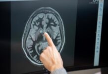 Logran medir la actividad cerebral de una paciente tratada con un fármaco antiobesidad fármaco