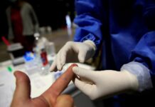 Una gota de sangre de la yema del dedo podría servir para detectar el alzhéimer sangre