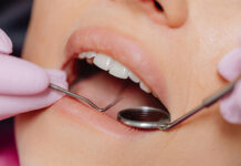 Estudio revela que las pérdidas dentales inciden en el aumento de peso